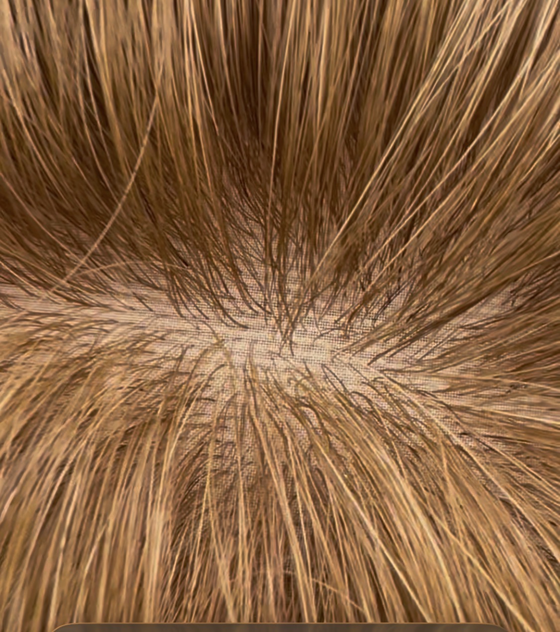 Naturalna peruka medyczna – Lace Front, imitacja skóry głowy